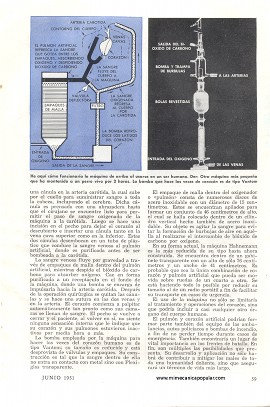 Substitutos para el Corazón y los Pulmones - Junio 1951